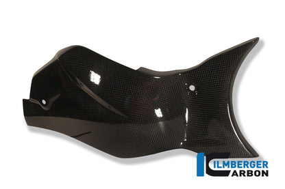 Heckschwingenabdeckung Carbon CB1000R Honda CB1000R (2008-2017)